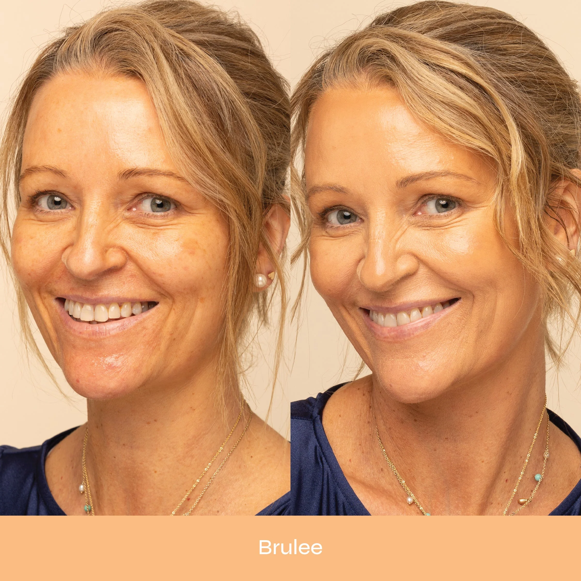 Dewy Bounce Radiant, Lightweight & Hydrating Skin Tint SPF 30 - Image 16